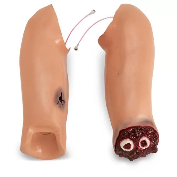Simulaids Trauma Randy Arm Flash Moulage